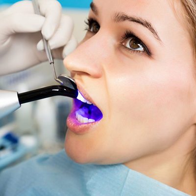How Dental Bonding Can Help Sensitive Teeth - Smilow Family Dentistry, P.C.  Springfield Township New Jersey